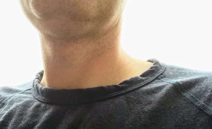 Pistol Lake Eudae Collar
